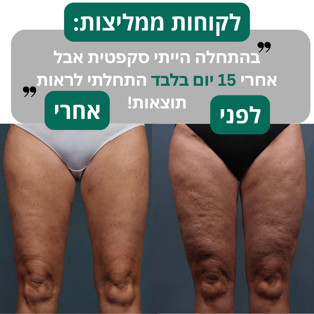 מכשיר עיסוי נגד צלוליטיסglowlift