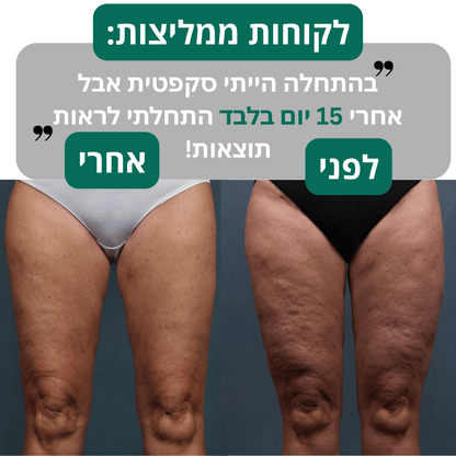 מכשיר עיסוי נגד צלוליטיסglowlift
